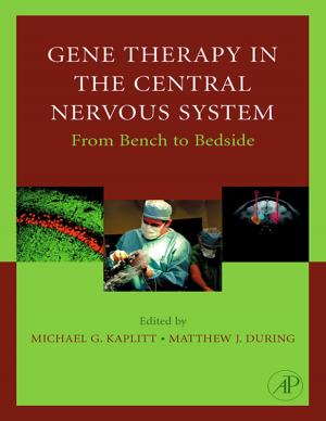 bigCover of the book Gene Therapy of the Central Nervous System: From Bench to Bedside by 
