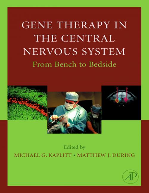 Cover of the book Gene Therapy of the Central Nervous System: From Bench to Bedside by , Elsevier Science
