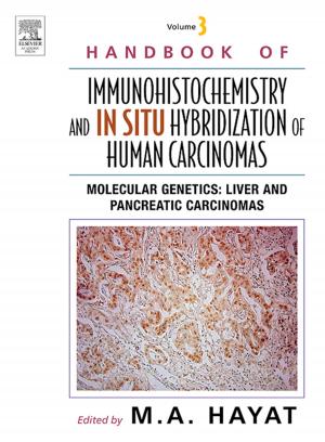 Cover of the book Handbook of Immunohistochemistry and in situ Hybridization of Human Carcinomas by Sharon L. Johnson