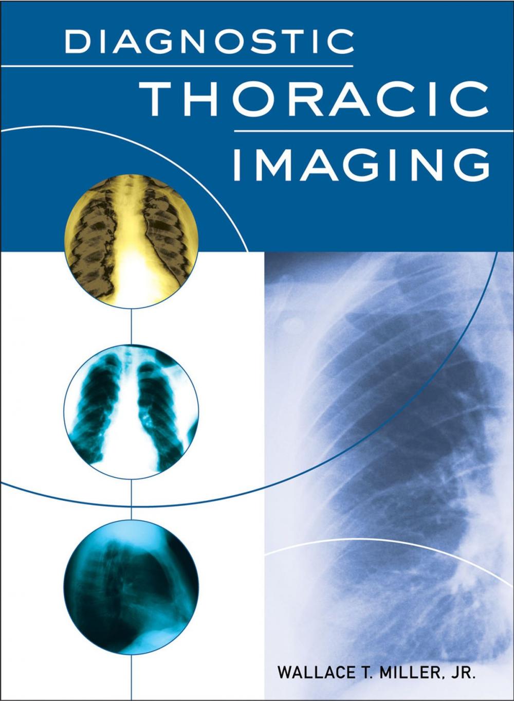 Big bigCover of Diagnostic Thoracic Imaging