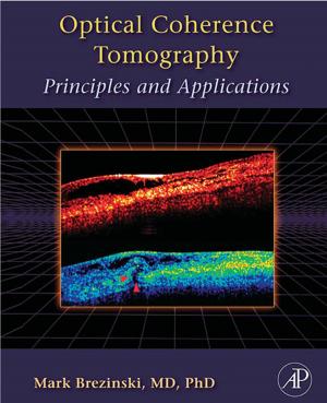 Cover of the book Optical Coherence Tomography by Crispian Scully, Jacobo Limeres Posse, Pedro Diz Dios, PhD, MD, MDS