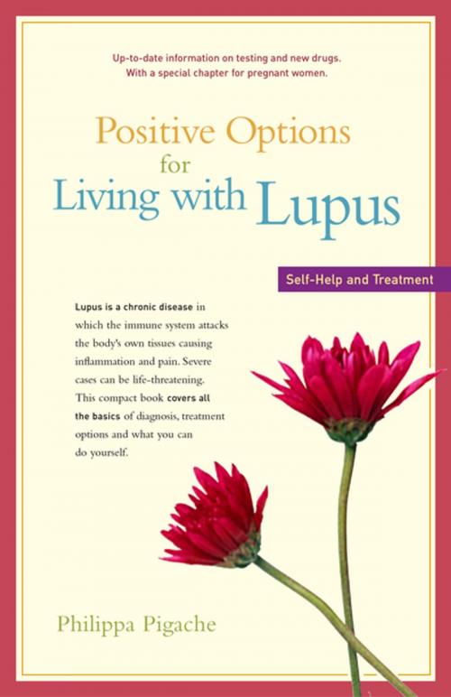 Cover of the book Positive Options for Living with Lupus by Philippa Pigache, Turner Publishing Company
