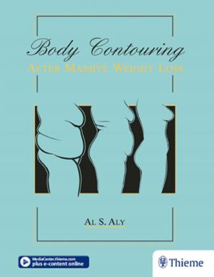 Cover of the book Body Contouring after Massive Weight Loss by Rudolf Beer, Michael A. Baumann