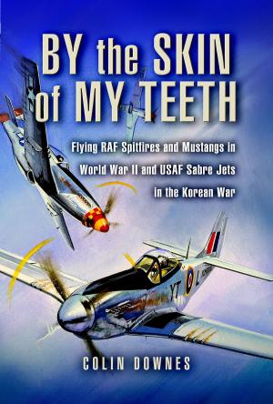 Cover of the book By the Skin of my Teeth by Captain Kincaid