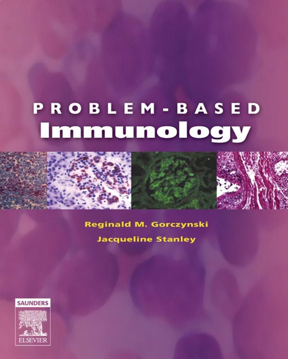 Big bigCover of Problem-Based Immunology E-Book