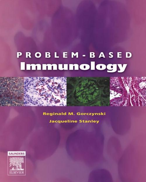 Cover of the book Problem-Based Immunology E-Book by Reginald M. Gorczynski, MD, Jacqueline Stanley, PhD, Elsevier Health Sciences