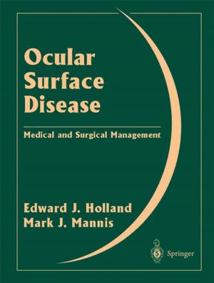 Cover of the book Ocular Surface Disease by Jianfeng Zhang