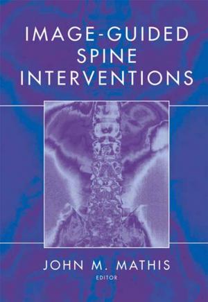 Cover of the book Image-Guided Spine Interventions by Percival McCormack