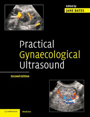 Cover of the book Practical Gynaecological Ultrasound by Paul Warde