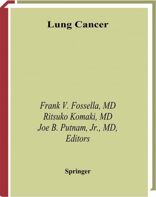 Cover of the book Lung Cancer by , Springer New York