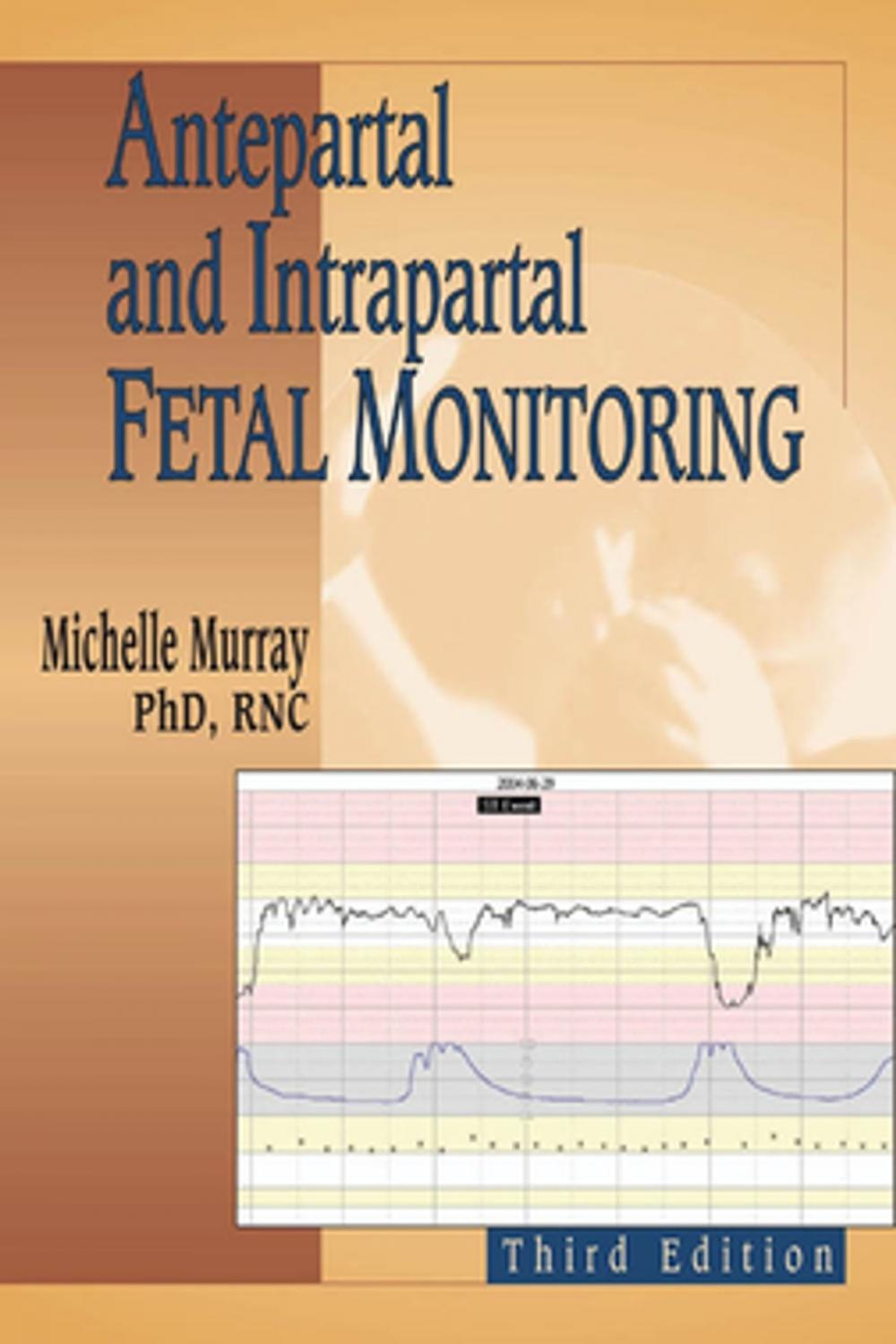 Big bigCover of Antepartal and Intrapartal Fetal Monitoring