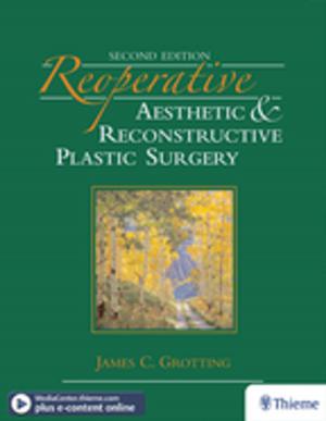 Cover of the book Reoperative Aesthetic & Reconstructive Plastic Surgery by Robert F. Spetzler, W. Koos, Johannes Lang