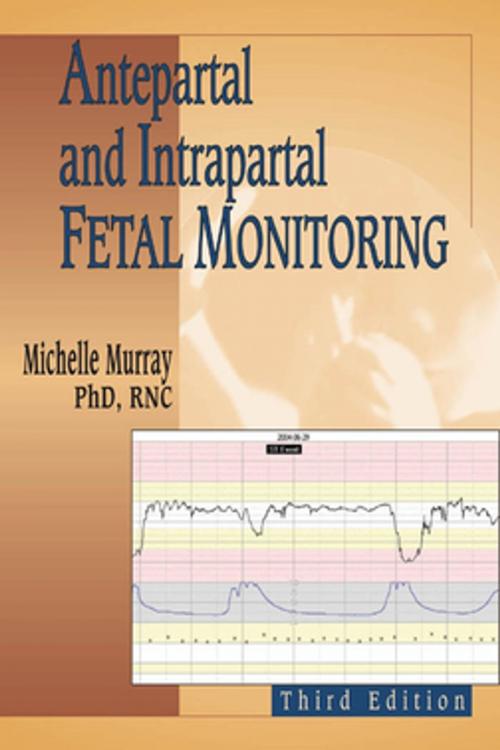 Cover of the book Antepartal and Intrapartal Fetal Monitoring by Michelle Murray, PhD, RNC, Springer Publishing Company