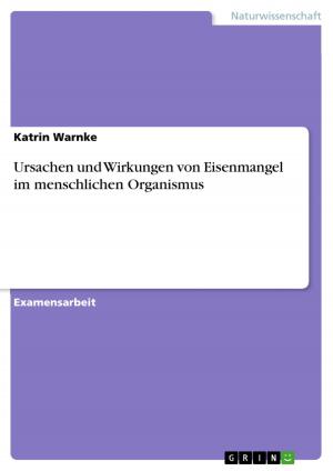Cover of the book Ursachen und Wirkungen von Eisenmangel im menschlichen Organismus by Meike Brinkmann