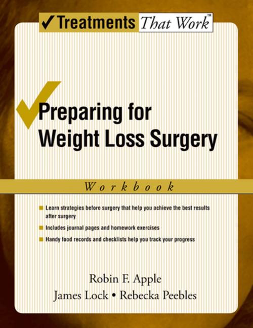 Cover of the book Preparing for Weight Loss Surgery by Robin F. Apple, James Lock, Rebecka Peebles, Oxford University Press