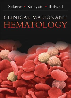 Cover of the book Clinical Malignant Hematology by Nigel Calder