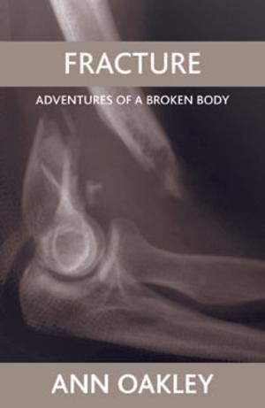 Cover of the book Fracture by 