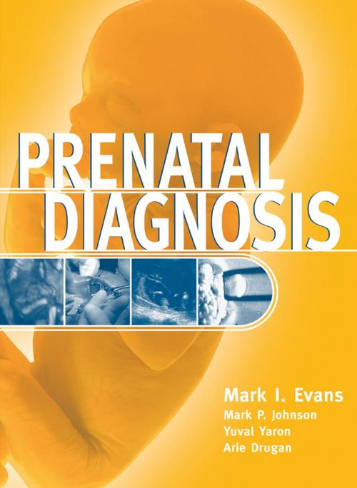 Cover of the book Prenatal Diagnosis by Mark I. Evans, McGraw-Hill Education