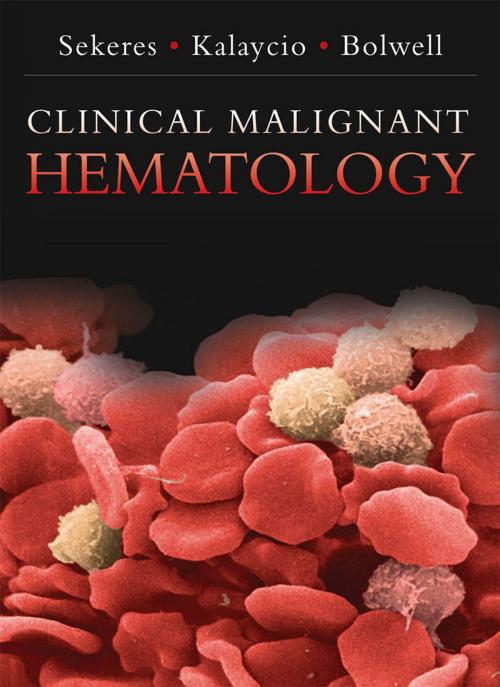 Cover of the book Clinical Malignant Hematology by Mikkael A. Sekeres, Matt Kalacyio, Brian Bolwell, McGraw-Hill Education