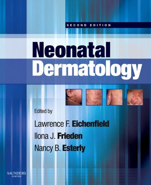 Cover of the book Neonatal Dermatology E-Book by Lawrence F. Eichenfield, MD, Ilona J. Frieden, MD, Andrea Zaenglein, MD, Erin Mathes, MD, Nancy B. Esterly, MD, Elsevier Health Sciences