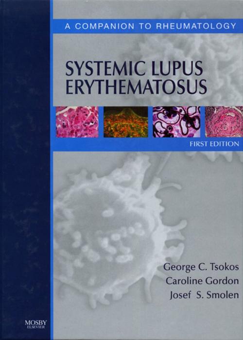Cover of the book Systemic Lupus Erythematosus E-Book by George Tsokos, Caroline Gordon, Josef S. Smolen, MD, FRCP, Elsevier Health Sciences