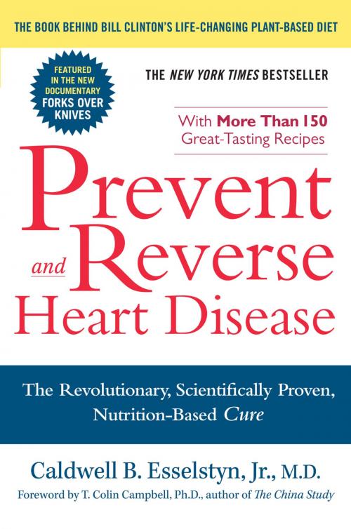 Cover of the book Prevent and Reverse Heart Disease by Caldwell B. Esselstyn, Jr. M.D., Penguin Publishing Group