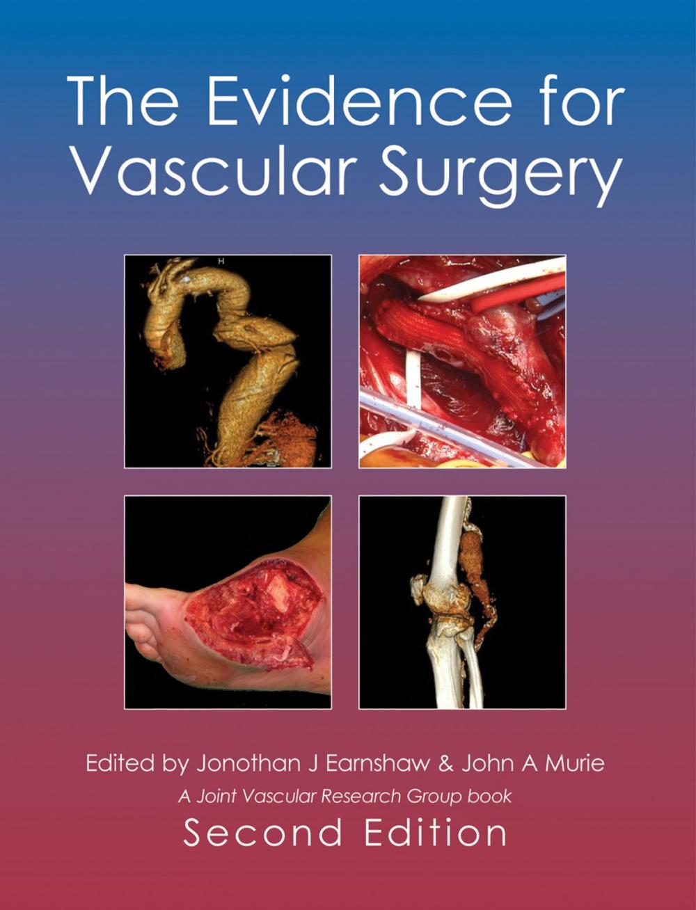 Big bigCover of The Evidence for Vascular Surgery; second edition