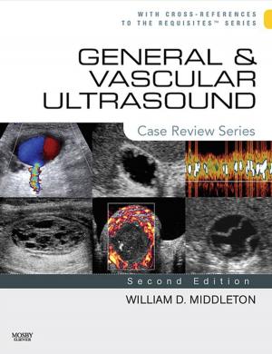 Cover of the book General and Vascular Ultrasound E-Book by James Swain, MPT, Kenneth W. Bush, MPT, Phd, Juliette Brosing, PhD