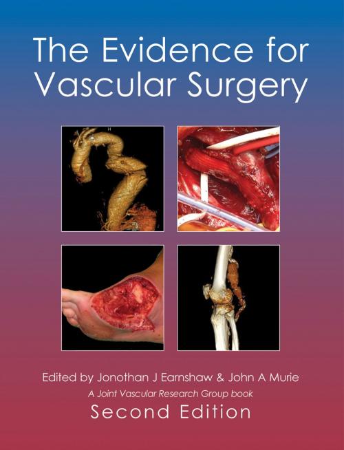 Cover of the book The Evidence for Vascular Surgery; second edition by , tfm Publishing Ltd