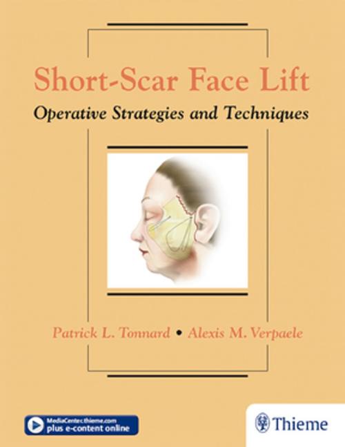 Cover of the book Short-Scar Face Lift by Patrick L. Tonnard, Alexis M. Verpaele, Thieme