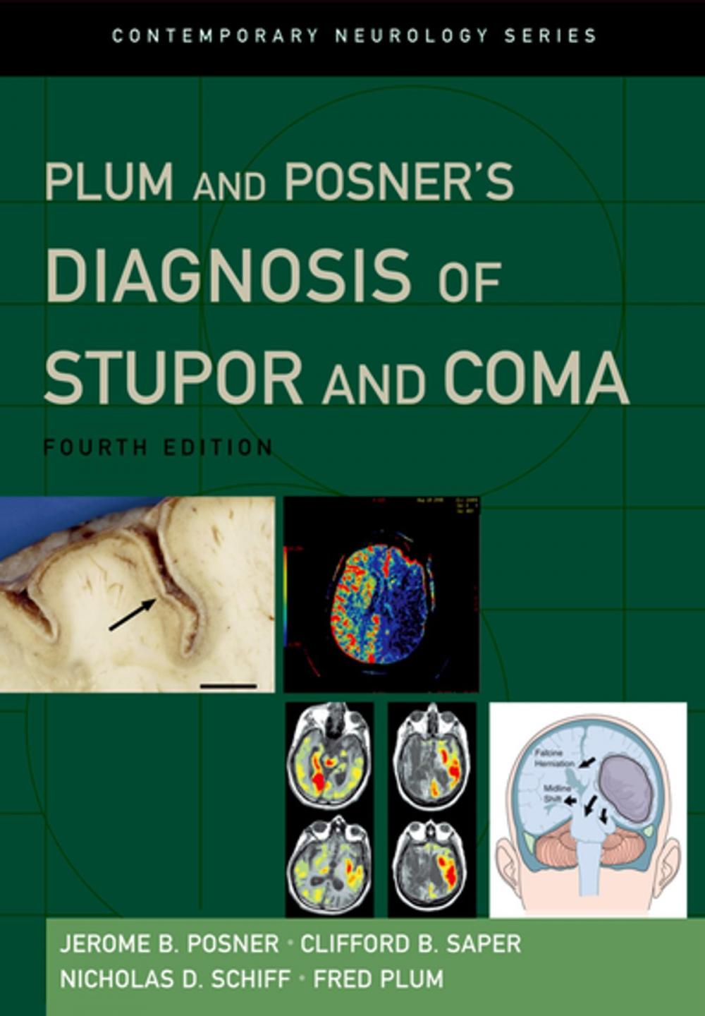 Big bigCover of Plum and Posner's Diagnosis of Stupor and Coma