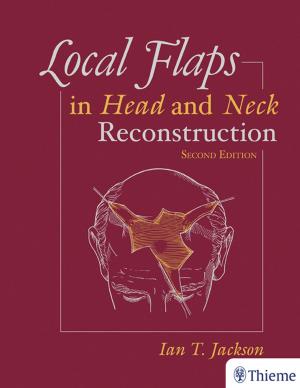 Book cover of Local Flaps in Head and Neck Reconstruction