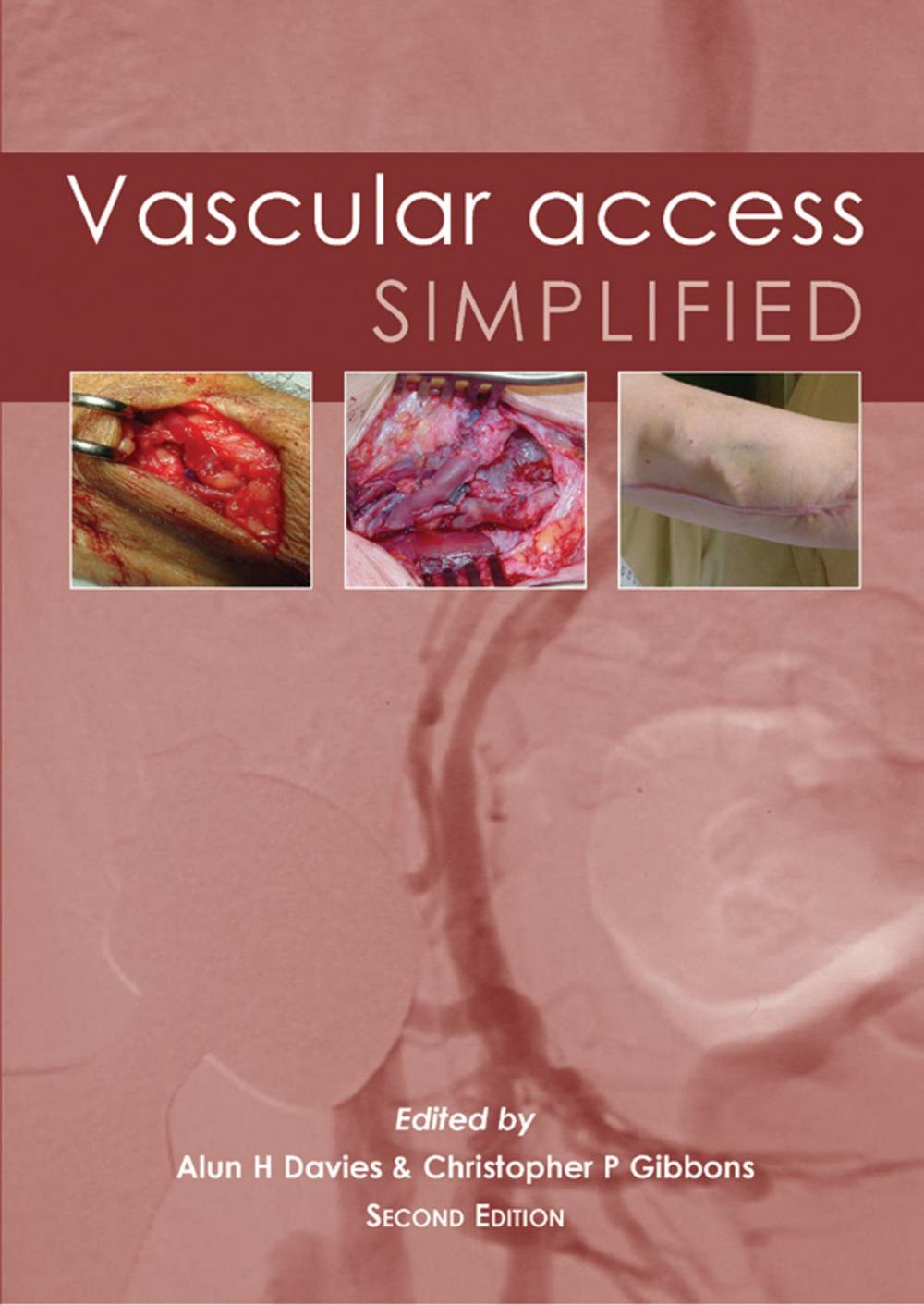 Big bigCover of Vascular Access Simplified; second edition