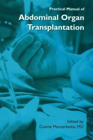 Cover of the book Practical Manual of Abdominal Organ Transplantation by Elena R. Dobrovinskaya, Leonid A. Lytvynov, Valerian Pishchik