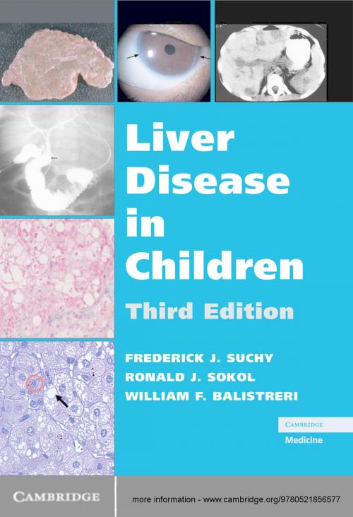 Cover of the book Liver Disease in Children by , Cambridge University Press