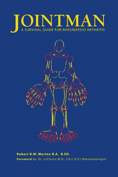Cover of the book Jointman, a Survival Guide for Rheumatoid Arthritis by Robert B.W. Morton, Trafford Publishing