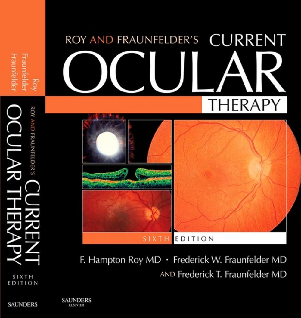 Big bigCover of Roy and Fraunfelder's Current Ocular Therapy E-Book