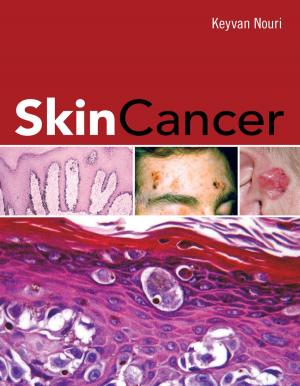 Cover of the book Skin Cancer by Ethan Rasiel, Ph.D. Paul N. Friga