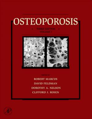 Cover of the book Osteoporosis by Peter Wilson
