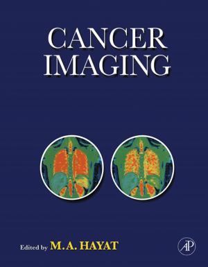 Cover of the book Cancer Imaging by K.P. Prabhakaran Nair
