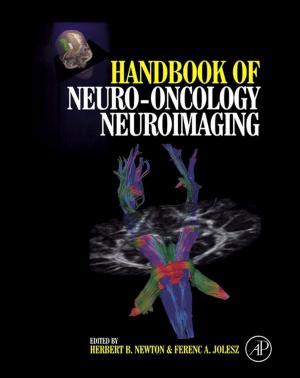 Cover of the book Handbook of Neuro-Oncology Neuroimaging by Zhuming Bi, Ph.D.