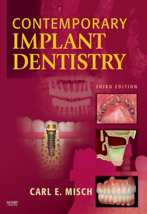 Cover of the book Contemporary Implant Dentistry by Anurag Agrawal, MBBS, PhD, FCCP