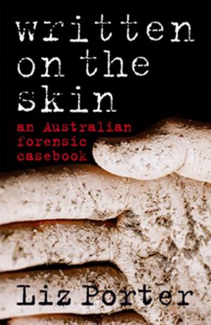 Cover of the book Written on the Skin by Fletcher Anthony