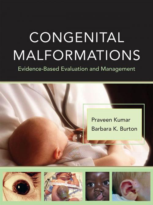 Cover of the book Congenital Malformations: Evidence-Based Evaluation and Management by Praveen Kumar, Barbara K. Burton, McGraw-Hill Education
