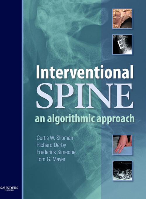 Cover of the book Interventional Spine E-Book by Curtis W. Slipman, MD, Richard Derby, MD, Frederick A. Simeone, MD, Tom G. Mayer, MD, Elsevier Health Sciences