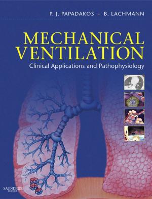 Cover of the book Mechanical Ventilation E-Book by Mary Ann E. Zagaria, PharmD