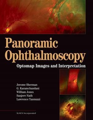 Cover of the book Panoramic Ophthalmoscopy by Adrian S. Bruce, Michael Stephen Loughnan