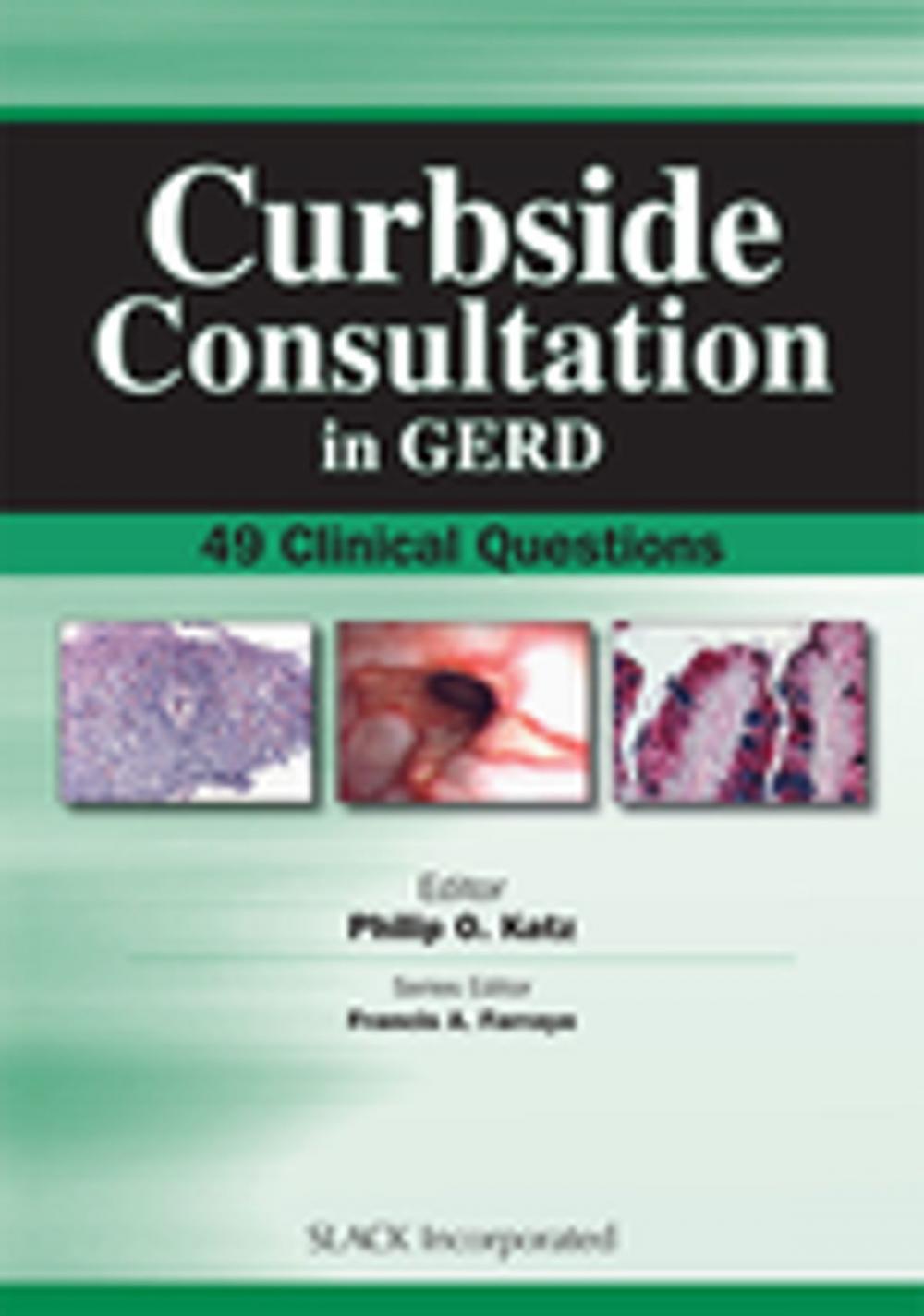 Big bigCover of Curbside Consultation in GERD