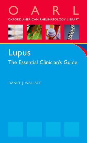 Book cover of Lupus
