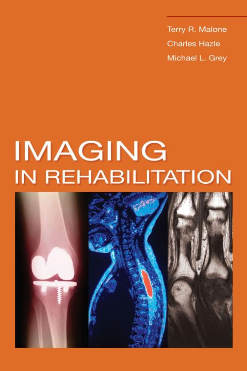 Cover of the book Imaging In Rehabilitation by Terry R. Malone, Charles Hazle, Michael L Grey, McGraw-Hill Education